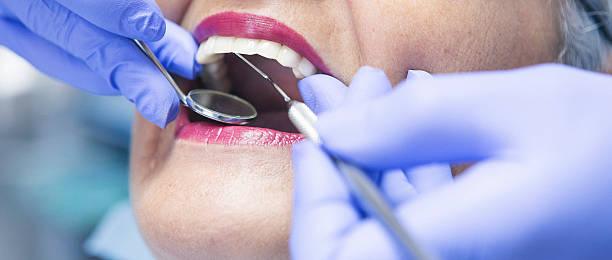 Best Emergency Root Canal Treatment in Washington, PA